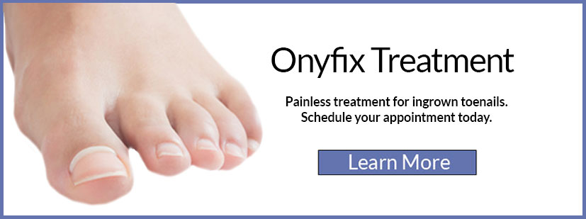 Onyfix Treatment