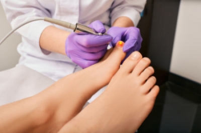 Facts About Laser Surgery for Toenail Fungus