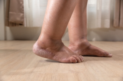 Common Causes of Foot and Ankle Swelling