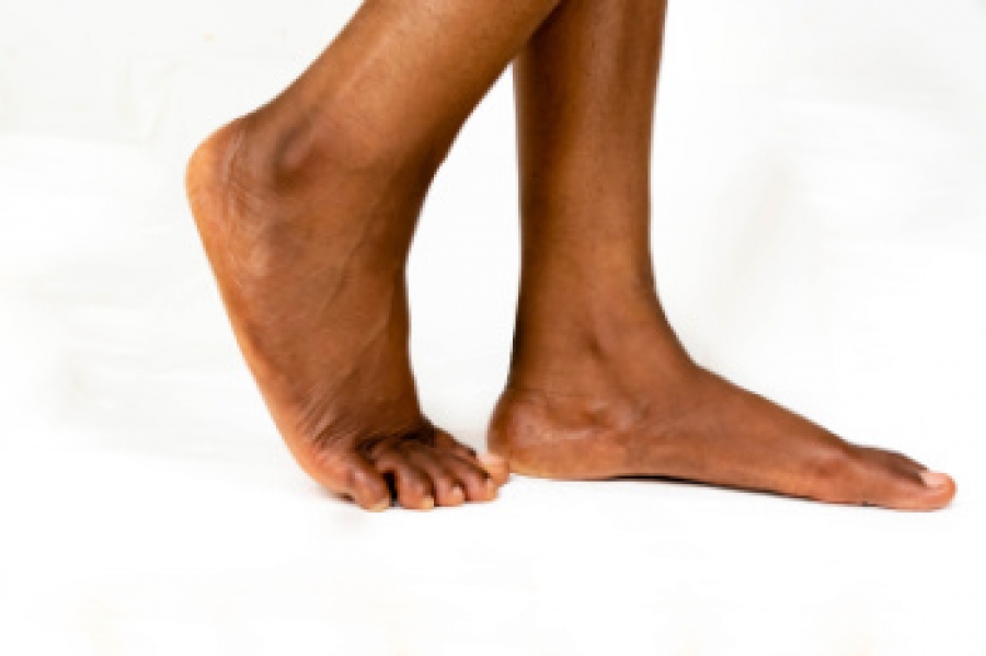 Surgery Options for Flat Feet